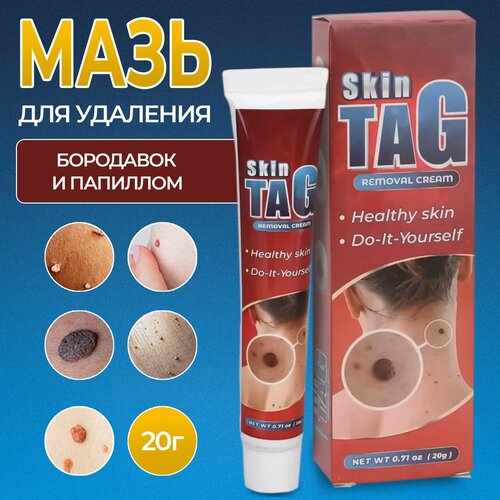 ���������� ���� ��� �������� ��������� � �������� 20�