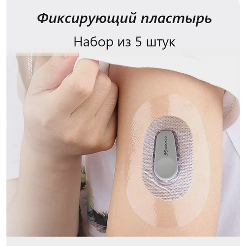 ���������� ����������� �������� ��� DEXCOM G6, ����������, ����������� / 5 ��
